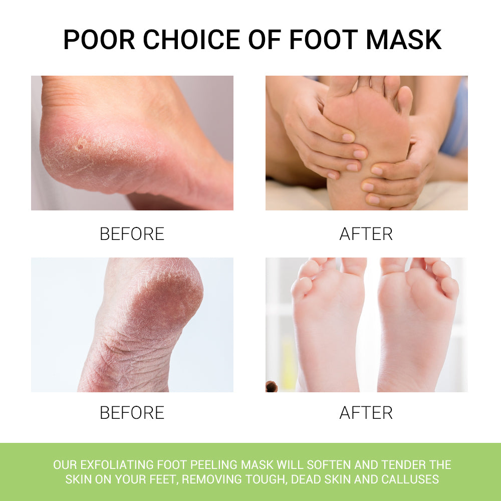 Exfoliating Foot mask One Sheet