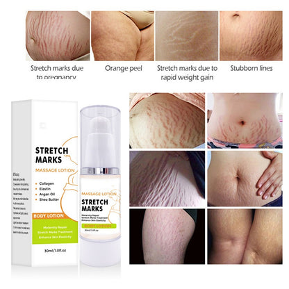 Massage Lotion For Stretch Marks, Pregnancy Skin Care, Belly Cream With Collagen Argan Oil And Shea Butter