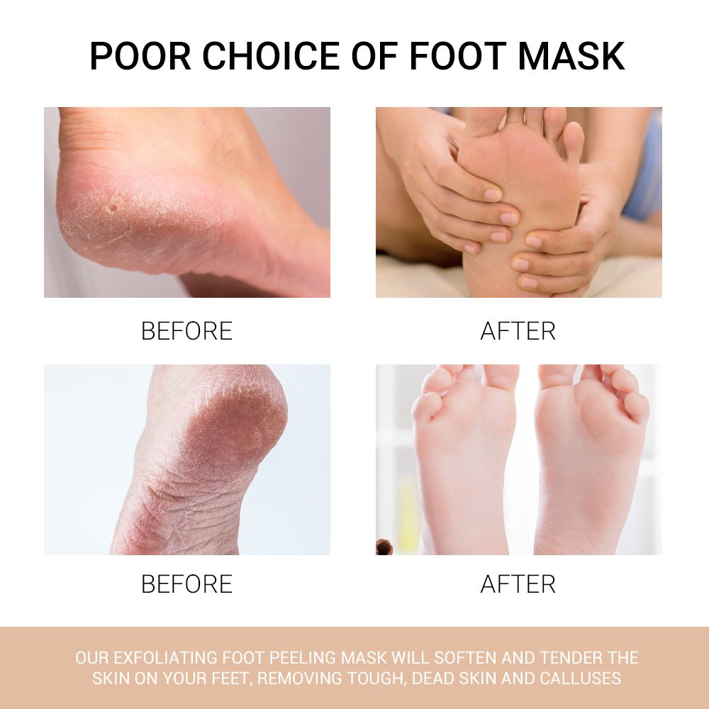 Foot peel mask (peach scent) 55 g/1.9 fl.oz