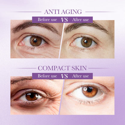 Reduce Fine Lines Anti Wrinkle Retinol Firming Anti-aging Eye Cream