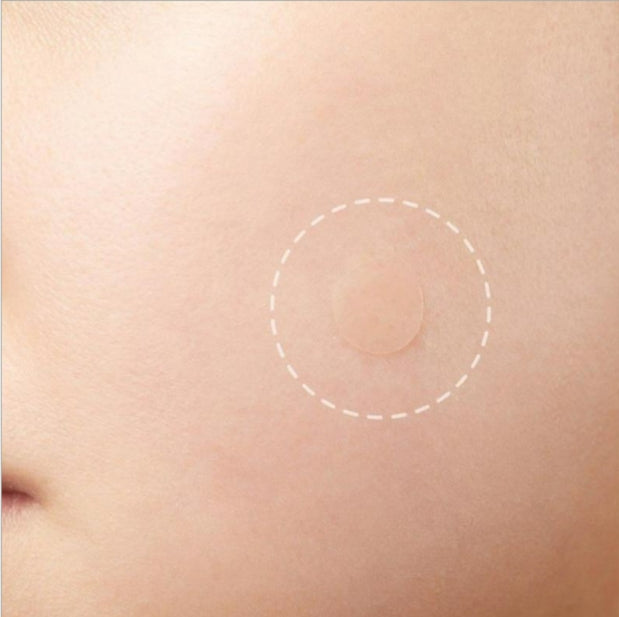 OEM Spot Patches Acne Treatment For Face Hydrocolloid Pimple Patches Spot Stickers 36 Patches