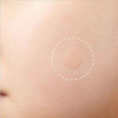 OEM Spot Patches Acne Treatment For Face Hydrocolloid Pimple Patches Spot Stickers 36 Patches