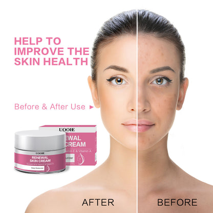 Hydrating Skin Smoothing Fine Lines Renewal Skin Cream 30g